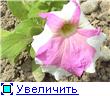 , у меня мама по необходимости стала принимать кальций в таблетках