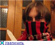 Зубы вставили, мраморные, несомненно, красивы, но чешутся десны, но мы потерпим, приступит к задани...